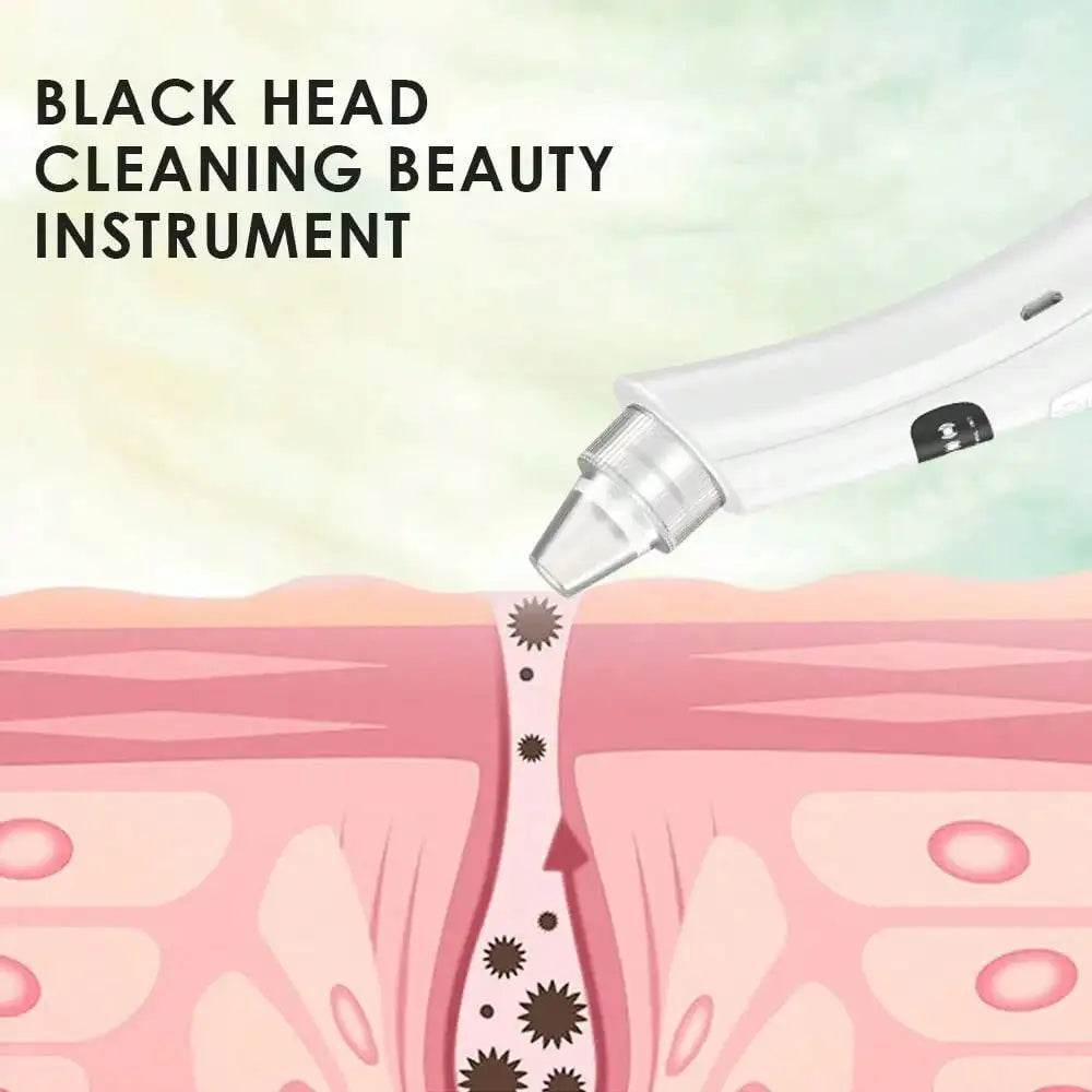 Blackhead Remover – Novacare™